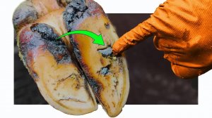 PICKING_STONES_out_of_COW's_HOOVES_&_a_BAD_WHITE_LINE_PROBLEM