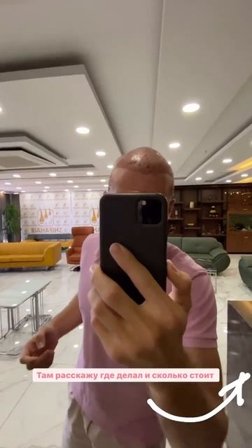 Трансплантация волос в Турции Стамбул, Дар Аль Шифа х? смотреть онлайн