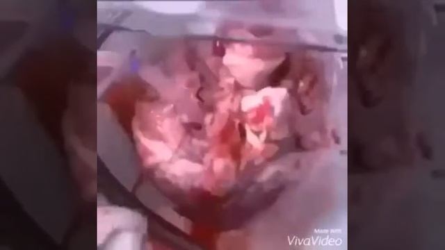 Пересадка сердца смотреть онлайн