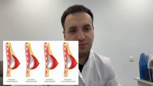 Маммопластика. Увеличение груди. Все что нужно знать о пластике груди.