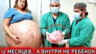 ЭТО НЕ ТВОЙ РЕБЕНОК!" – ШОКИРУЮЩИЙ РЕЗУЛЬТАТ ТЕСТА ДНК