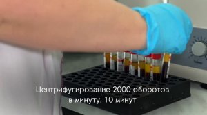 Процедура проведения исследования крови на биохимическом анализаторе  VitaRay 420