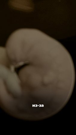 Клетки малыша остаются в маме навсегда?