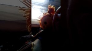 Алиса сломала руку