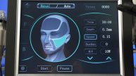 SMAS 4D HIFU для подтяжки и микроигольчатый RF для лифтинга