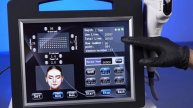 SMAS 4D для лифтинга и омоложение лица и тела