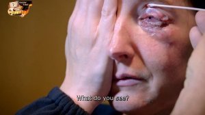 Аномалии тела  сезон  эп  Пересадка зуба в глаз, чтоб сп