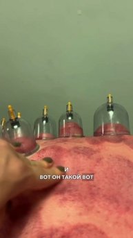 Лимфостаз: как распознать и что делать?