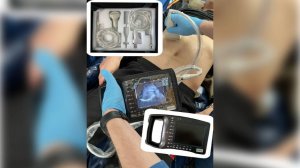 Портативный УЗИ-аппарат появился в нефтеюганской станции скорой медицинской помощи