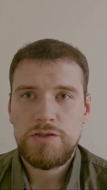 НУ НАКОНЕЦ-ТО ВОЛОСЫ! Дневник Пересадки смотреть онлайн