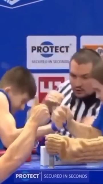 Перелом руки😬