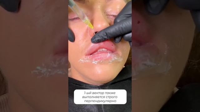 Увеличение губ ❤️ плоский бант иглой на 25mm смотреть онлайн