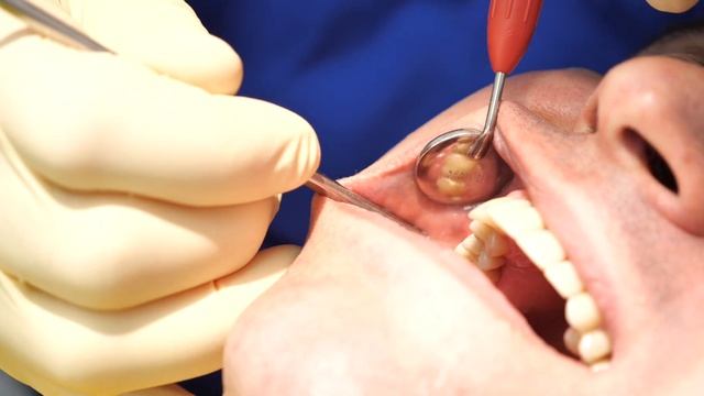 Сергей Бритаев – лечащий врач, стоматолог. Клиника "Зубная здравница". Владикавказ, ул. Джанаева 16 смотреть онлайн