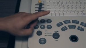 Обзор аппарата УЗИ Edan Dus 60