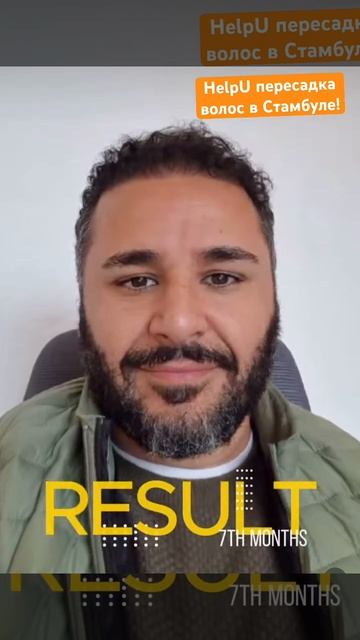 Пересадка волос Стамбул! HelpU пересадка волос! https://transpla смотреть онлайн