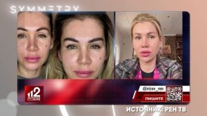 КОШМАРНЫЕ последствия ПЕРЕСАДКИ БРОВЕЙ! / Что такое СИ