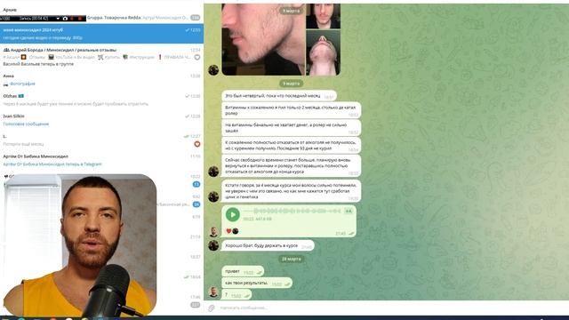 Как запустить рост бороды в 18 лет. Результаты до и посл