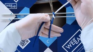 Формирование петли по способу Джанелидзе