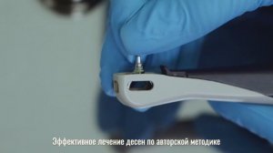 Лечение пародонтита на аппарате Vector