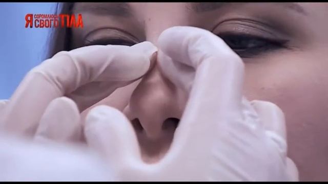 Комп'ютерна томографія, яка дасть оцінити наслідки травми. смотреть онлайн