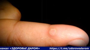 КАК ИСПОЛЬЗОВАТЬ ЯБЛОЧНЫЙ УКСУС В БЫТУ