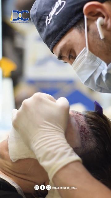 клиника Dream International по пересадке волос из Турции Стамб? смотреть онлайн