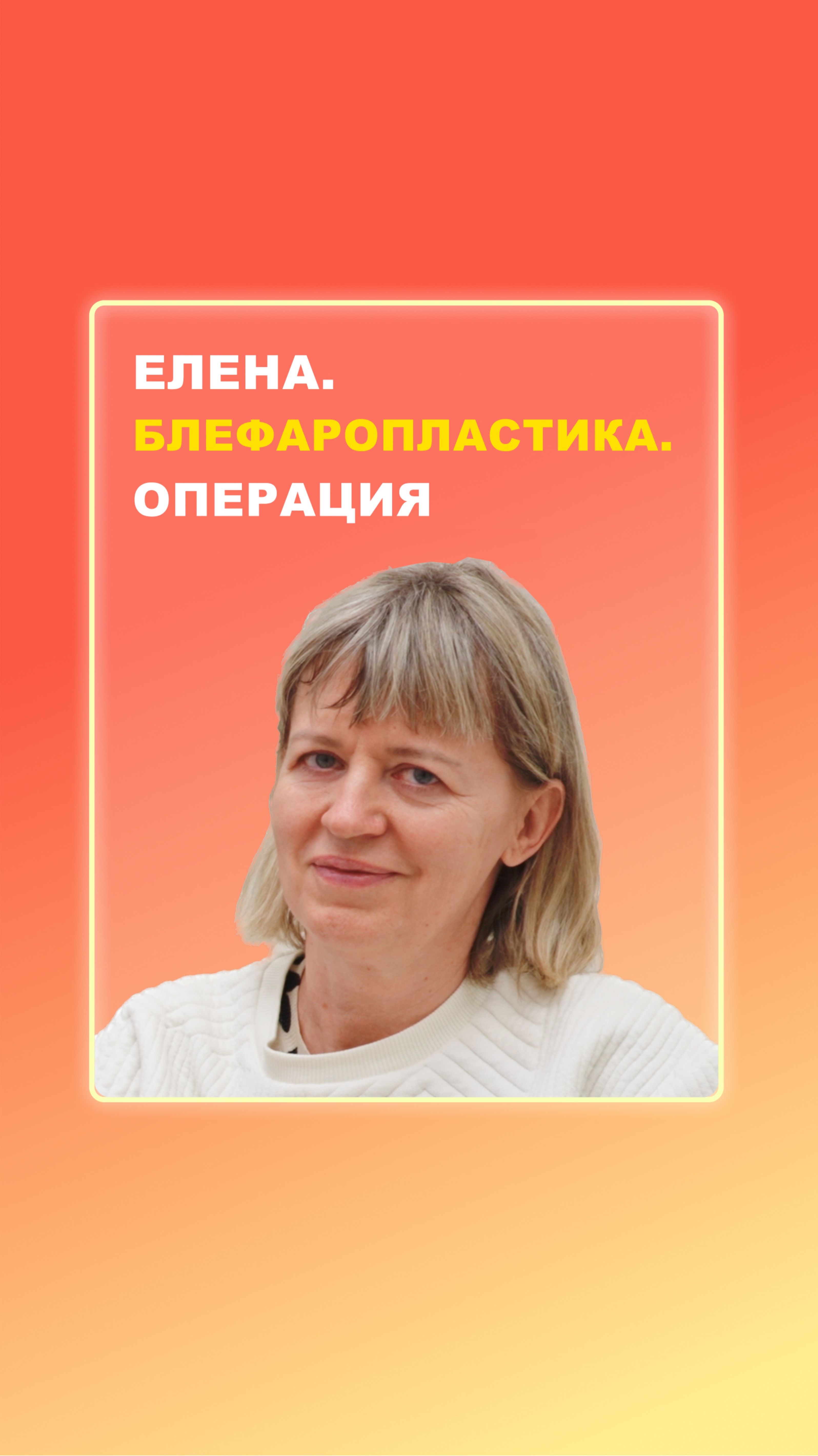 Елена. Блефаропластика. Операция