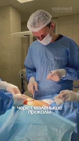 Почему Лапароскопия Лучше, Чем Обычные Операции? Как Удаляют Опухоли Без Шрамов?