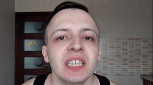 ЗАПИСАЛСЯ К СТОМАТОЛОГУ НА ПРОФЕССИОНАЛЬНУЮ ЧИСТКУ ЗУБОВ ОТ ЗУБНОГО КАМНЯ ЧТОБЫ НАЙТИ ДЕВУШКУ