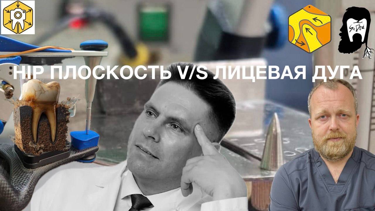 HIP-плоскость против лицевой дуги. Артикулятор против А.Б. Баранова. 1:1 победила дружба