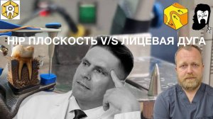 HIP-плоскость против лицевой дуги. Артикулятор против А.Б. Баранова. 1:1 победила дружба