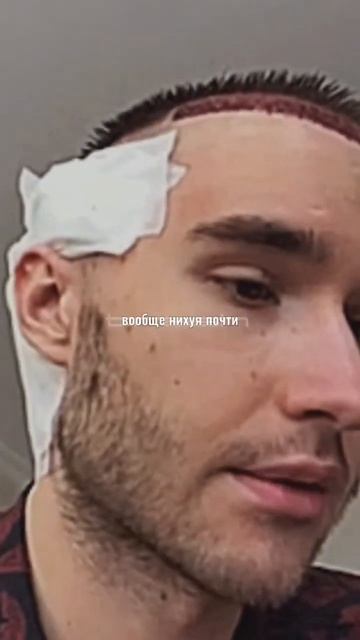 Кореш об пересадки волос😴 #хозяева #кореш смотреть онлайн