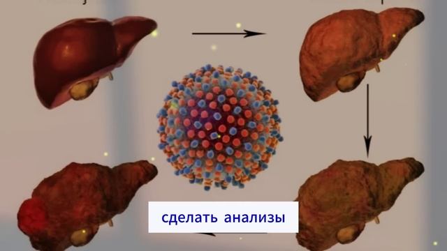 Если у вас есть ЭТИ симптомы на ногах, СРОЧНО проверьт?