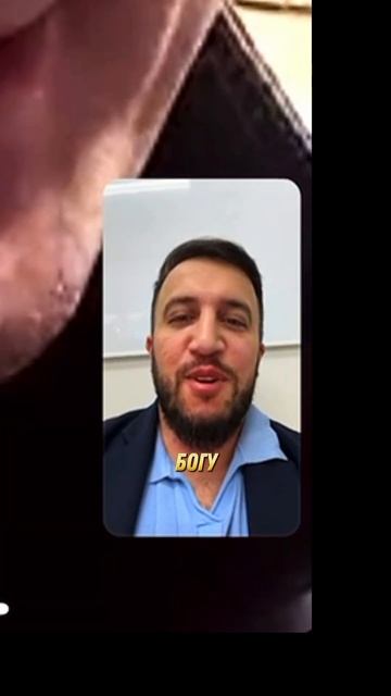 ОТЗЫВ ПЕРЕСАДКА ВОЛОС ДО ПОСЛЕ 168 смотреть онлайн