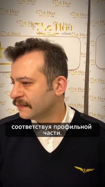 Лучший результат по пересадке волос. #пересадкаволос # смотреть онлайн