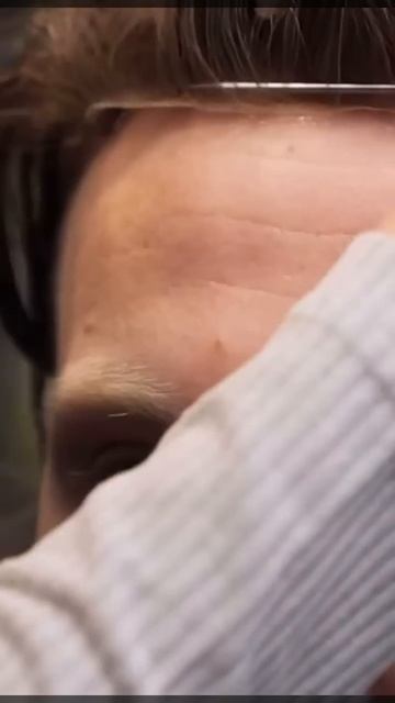 Не пересадка красноярск системаволос пересадкаволо