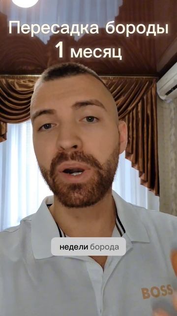 1 месяц после пересадки бороды / Андрей Борода #минокси