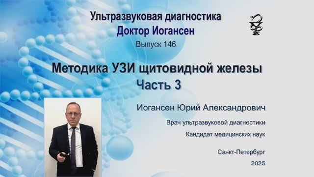 УЗИ. Доктор Иогансен. Выпуск 146. Методика УЗИ щитовидной железы. Часть 3.