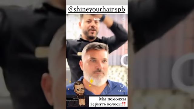 Как волосы меняют человека. Пересадка волос в России #? смотреть онлайн