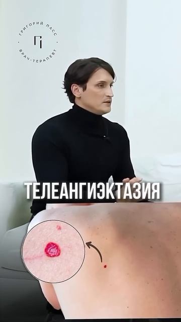 СТМПТОМЫ БОЛЬНОЙ ПЕЧЕНИ. КРАСНЫЕ ПЯТНА НА ТЕЛЕ #геманг