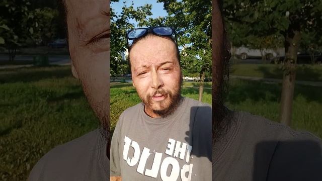 перед пересадкой бороды волнуюсь