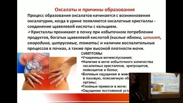 Камни в почках - 