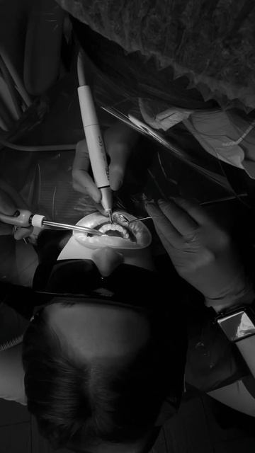 #shortvideo #стоматология #dentistry #reelsvideo смотреть онлайн