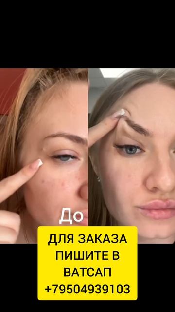 Уколы красоты не нужны, ведь есть коллаген. смотреть онлайн