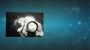 Как СОДА помогает восстановить ПРОСТАТУ? 99% мужчин не ?
