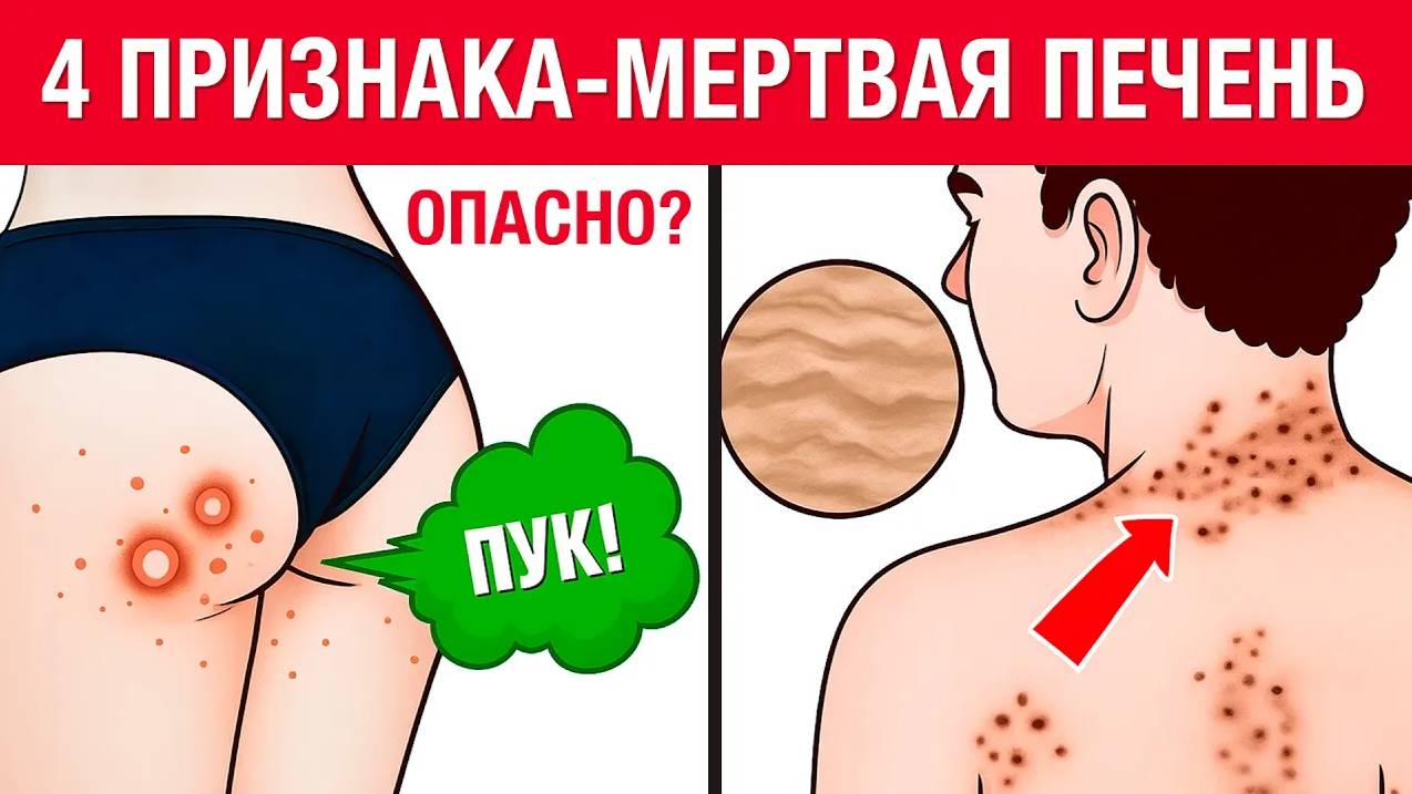 6 главных признаков УМИРАЮЩЕЙ ПЕЧЕНИ! Как быстро проверить здоровье печени.
