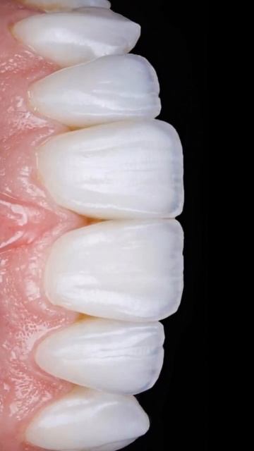 Эту работу сделал наш стоматолог-реставратор, ортопед смотреть онлайн