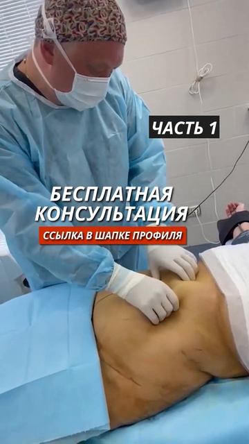 Убрали огромный жировой фартук и сделали идеальный пл