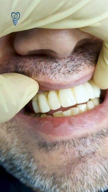 Через десять дней после операции у пациента нет пробл? смотреть онлайн