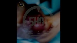 Что там с Эдвардом Билом? Ампутации не будет? | Эдвард Бил нога | Эдвард Бил самокатная полиция